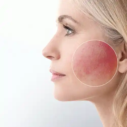 Alginat Peel-Off Maske