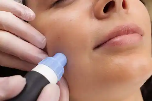 Sichere apparative Kosmetik mit NiSV- und APV-Fachkunde